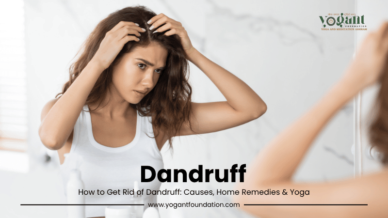 dandruff